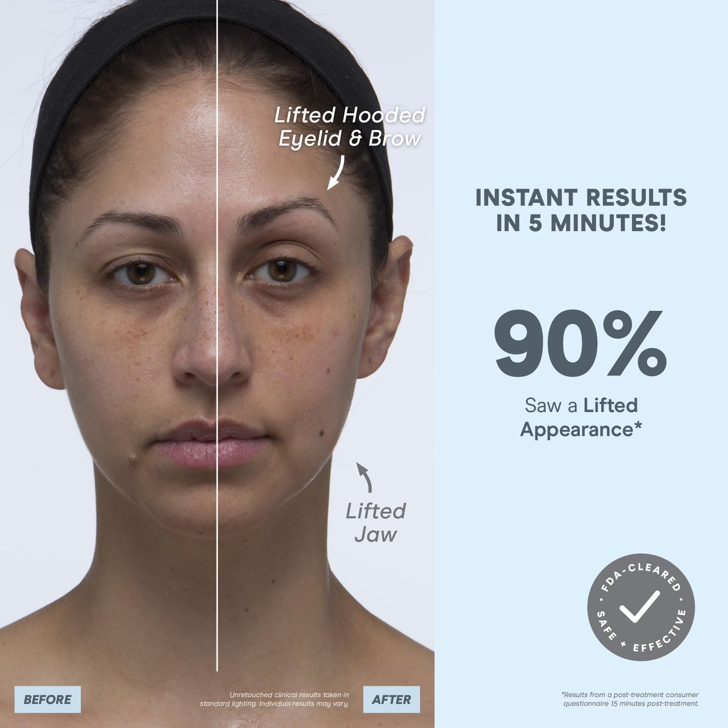Microcurrent Facial Device Kit