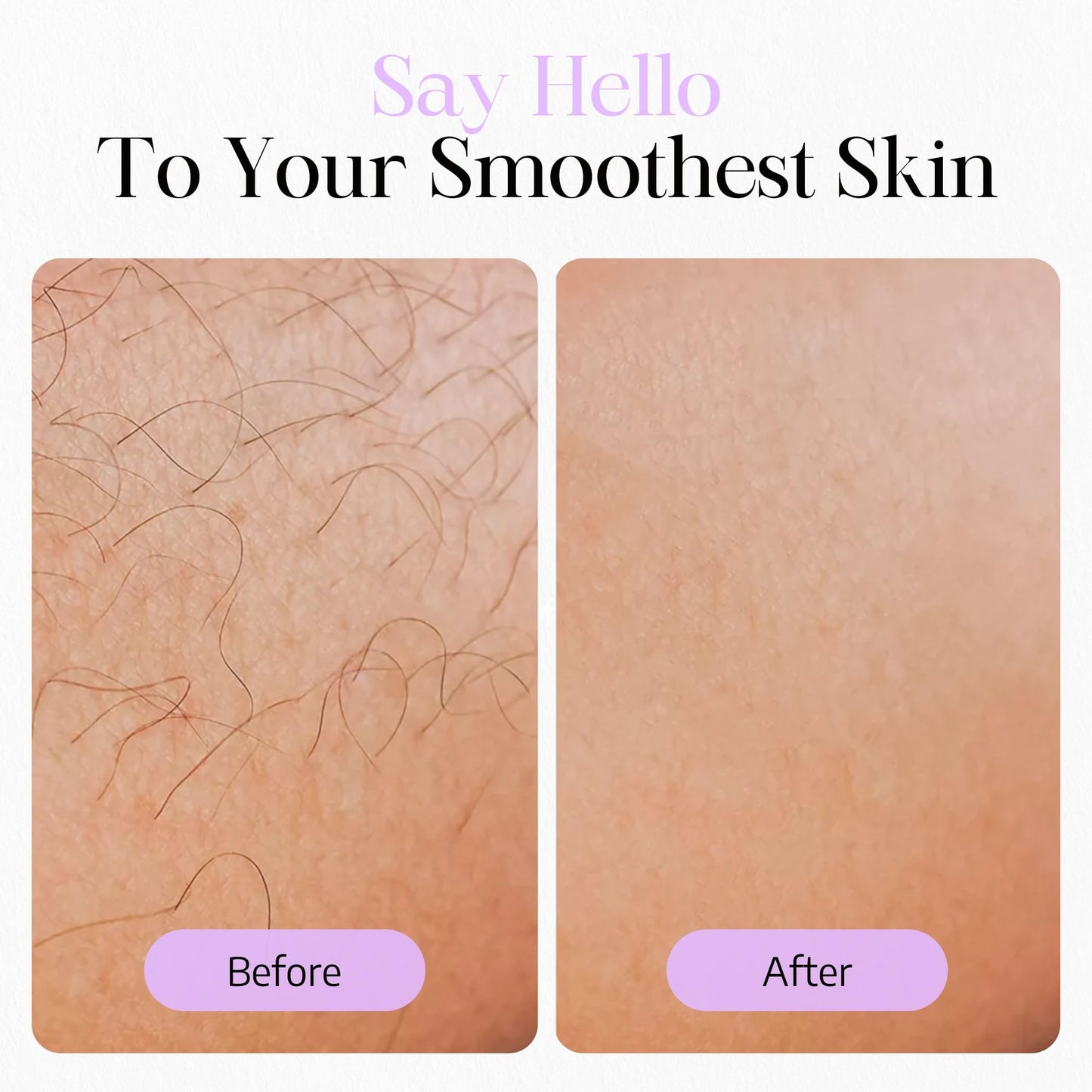 IPL Hair Removal Device for Face and Body