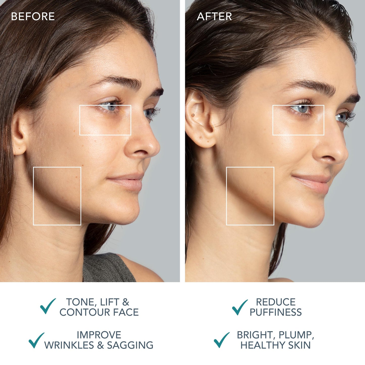 FOREO BEAR 2 Microcurrent Facial Device